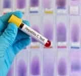 Campanie de testare pentru depistarea hepatitelor virale B/D și C în județul Prahova
