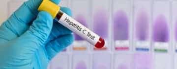 Campanie de testare pentru depistarea hepatitelor virale B/D și C în județul Prahova