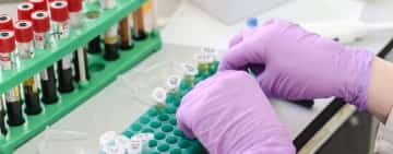 Direcția Sanitară Veterinară Prahova cumpără echipamente de laborator. Cele utilizate în prezent sunt vechi și au probleme