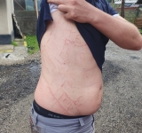 Un bărbat a scăpat ca prin minune cu viață după ce un fulger s-a descărcat în apropierea sa, pe munte!