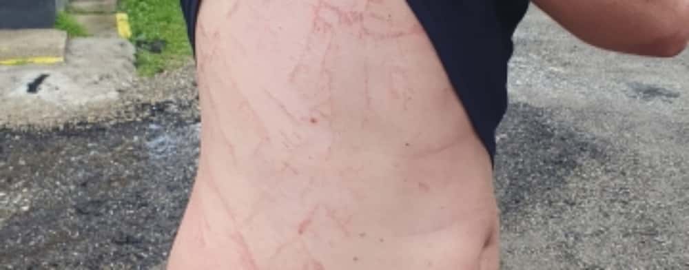 Un bărbat a scăpat ca prin minune cu viață după ce un fulger s-a descărcat în apropierea sa, pe munte!