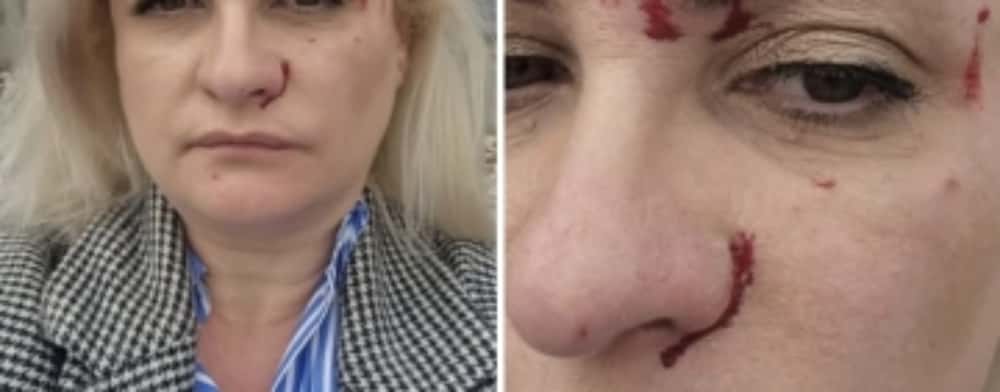 UPDATE/ Bătăușul care a lovit o femeie și un bărbat, în parcarea magazinului LIDL de pe strada Apelor din Ploiești, cercetat de poliție