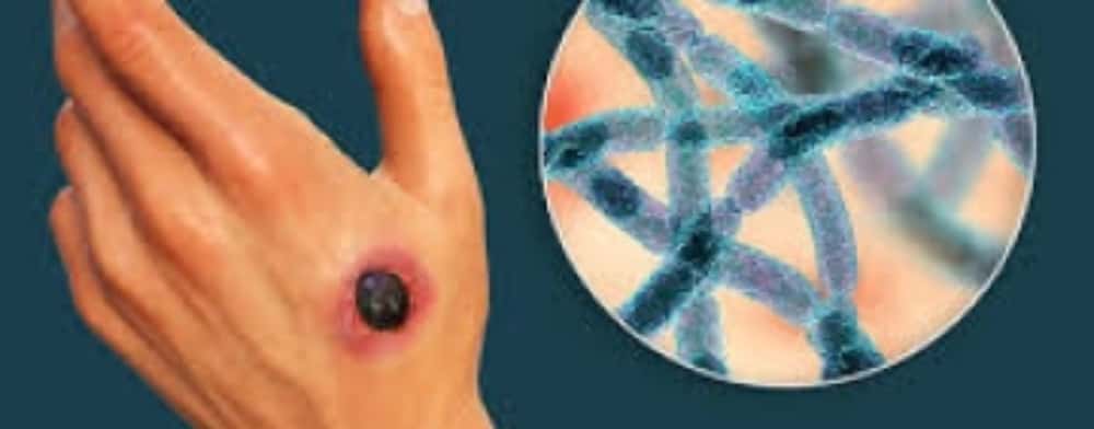 Suspiciune de ANTRAX, la Institutul Matei Balș!