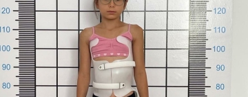 Un diagnostic descoperit întâmplător a schimbat copilăria Evei, o fetiță din Plopeni